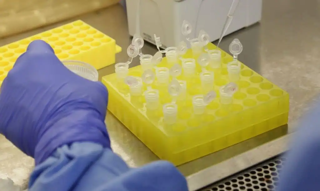 diagnostico_laboratorial_de_casos_suspeitos_do_novo_coronavirus_2801209411-e1587046196466